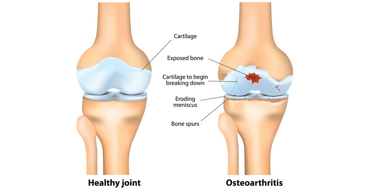 Knee joint anatomy